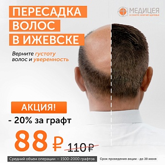 Бесшовная пересадка волос в Ижевске